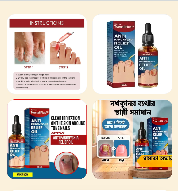 Anti Paronychia Relief Oil — ব্যবহারের নিয়ম, প্রোডাক্ট বোতল ও আগে-পরের ফলাফল